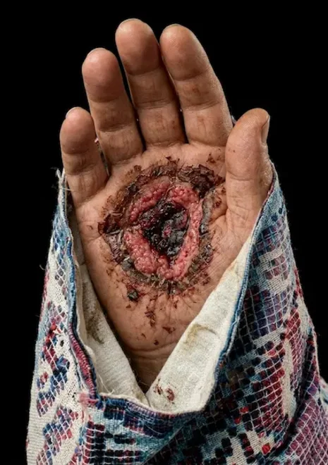 acrescentar-sangue-seco-chaga-202606211646.webp